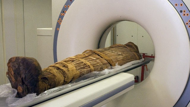 PHOTO: The mummy Hatiay is scanned in Cairo, Egypt, where it was found to have evidence of extensive vascular disease by CT scanning.