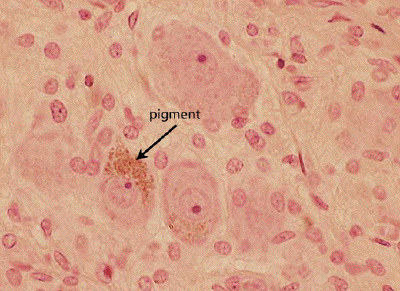 lipofuscin