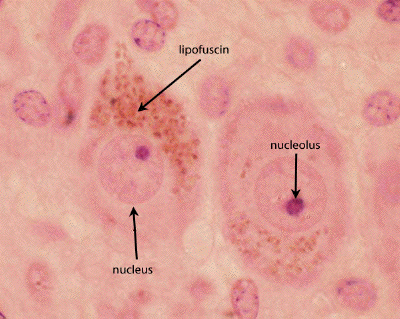 lipofuscin2